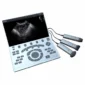 Portable Ultrasound Machine